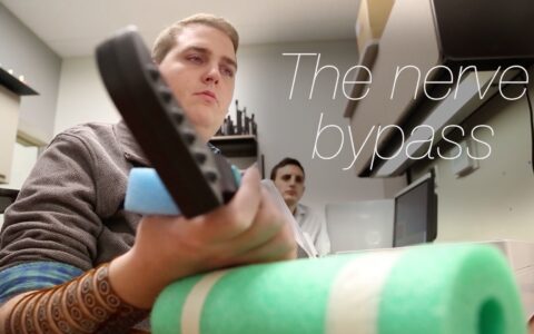 The nerve bypass: how to move a paralysed hand